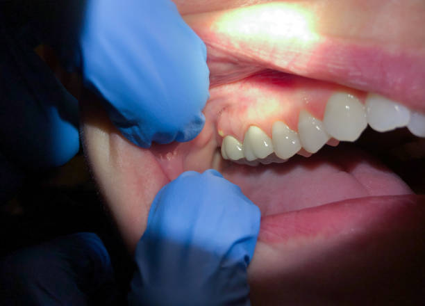 Best Emergency TMJ Treatment in Haworth, NJ
