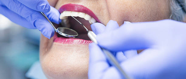 Best Emergency Tooth Extraction in Haworth, NJ